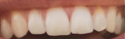 teeth